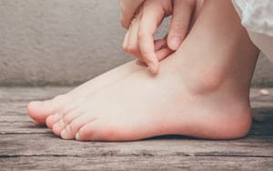 Best Foot Callus Removers of 2023